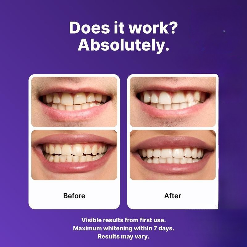 Bravetti Whitening Strips